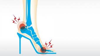 High Heel X-Ray Illustration.jpg